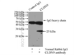 Claudin 9 Rabbit anti-Human, Mouse, Rat, Polyclonal, Proteintech 20 &mu;L;