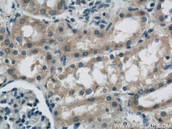 FRK Rabbit anti-Human, Mouse, Rat, Polyclonal, Proteintech 150 &mu;L; Unconjugated:Antibodies,