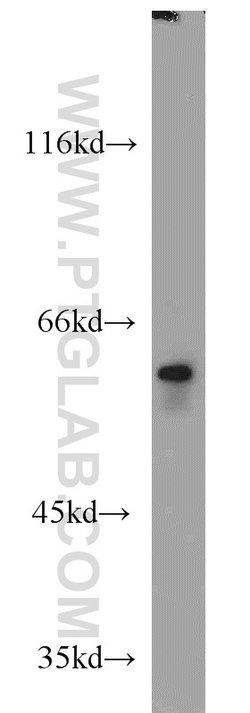FRK Rabbit anti-Human, Mouse, Rat, Polyclonal, Proteintech 150 &mu;L; Unconjugated:Antibodies,