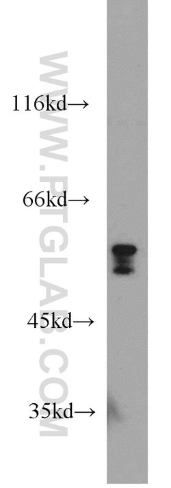 FRK Rabbit anti-Human, Mouse, Rat, Polyclonal, Proteintech 150 &mu;L; Unconjugated:Antibodies,