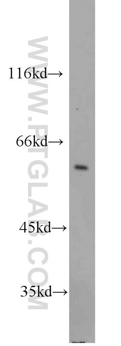 FRK Rabbit anti-Human, Mouse, Rat, Polyclonal, Proteintech 150 &mu;L; Unconjugated:Antibodies,