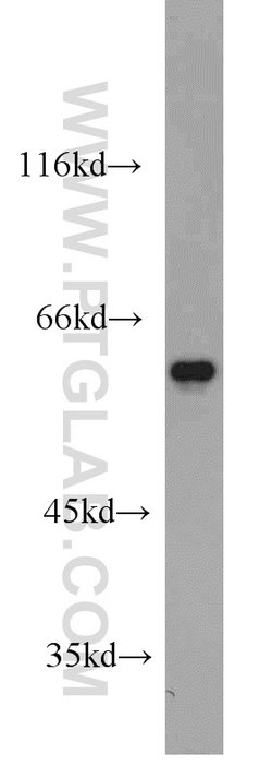 FRK Rabbit anti-Human, Mouse, Rat, Polyclonal, Proteintech 150 &mu;L; Unconjugated:Antibodies,