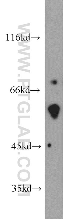 FRK Rabbit anti-Human, Mouse, Rat, Polyclonal, Proteintech 150 &mu;L; Unconjugated:Antibodies,