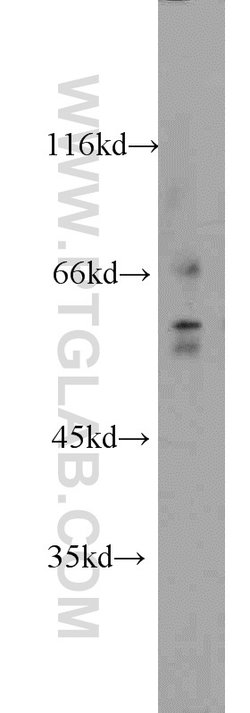 FRK Rabbit anti-Human, Mouse, Rat, Polyclonal, Proteintech 150 &mu;L; Unconjugated:Antibodies,