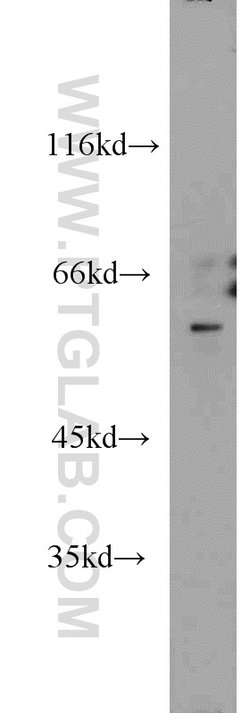 FRK Rabbit anti-Human, Mouse, Rat, Polyclonal, Proteintech 150 &mu;L; Unconjugated:Antibodies,