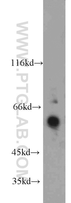FRK Rabbit anti-Human, Mouse, Rat, Polyclonal, Proteintech 150 &mu;L; Unconjugated:Antibodies,