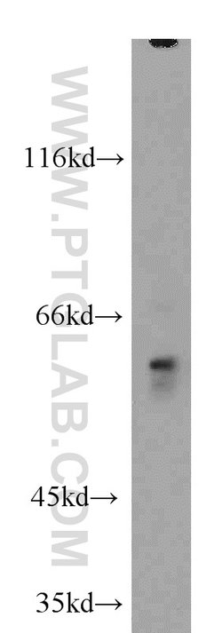 FRK Rabbit anti-Human, Mouse, Rat, Polyclonal, Proteintech 150 &mu;L; Unconjugated:Antibodies,
