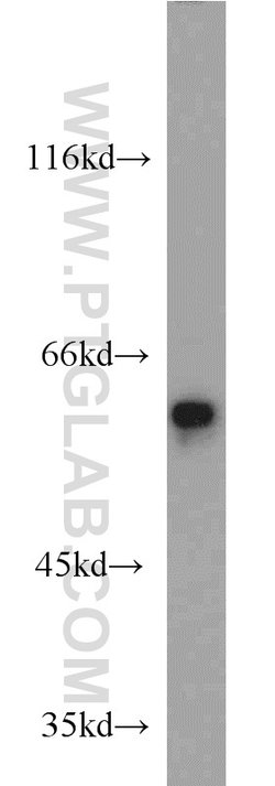 FRK Rabbit anti-Human, Mouse, Rat, Polyclonal, Proteintech 150 &mu;L; Unconjugated:Antibodies,