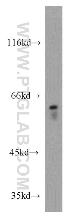 FRK Rabbit anti-Human, Mouse, Rat, Polyclonal, Proteintech 150 &mu;L; Unconjugated:Antibodies,