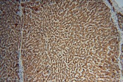 ACSS3 Rabbit anti-Human, Mouse, Rat, Polyclonal, Proteintech 150 &mu;L;