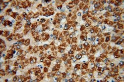 ACSS3 Rabbit anti-Human, Mouse, Rat, Polyclonal, Proteintech 150 &mu;L;