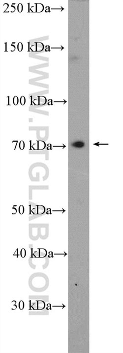 ACSS3 Rabbit anti-Human, Mouse, Rat, Polyclonal, Proteintech 150 &mu;L;