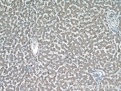 GGCX Rabbit anti-Human, Mouse, Rat, Polyclonal, Proteintech 150 &mu;L;