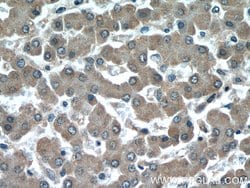 GGCX Rabbit anti-Human, Mouse, Rat, Polyclonal, Proteintech 150 &mu;L;