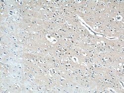 GGCX Rabbit anti-Human, Mouse, Rat, Polyclonal, Proteintech 150 &mu;L;