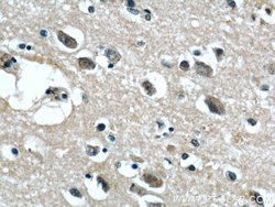 GGCX Rabbit anti-Human, Mouse, Rat, Polyclonal, Proteintech 150 &mu;L;