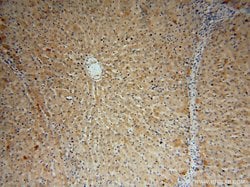 GGCX Rabbit anti-Human, Mouse, Rat, Polyclonal, Proteintech 150 &mu;L;