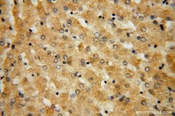 GGCX Rabbit anti-Human, Mouse, Rat, Polyclonal, Proteintech 150 &mu;L;