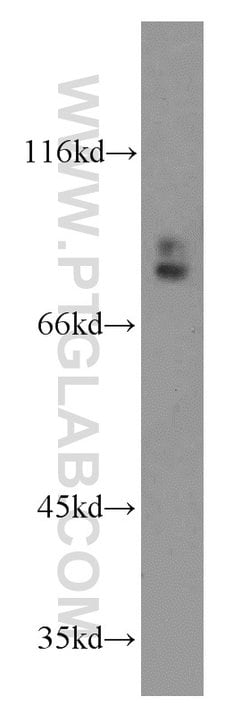GGCX Rabbit anti-Human, Mouse, Rat, Polyclonal, Proteintech 150 &mu;L;