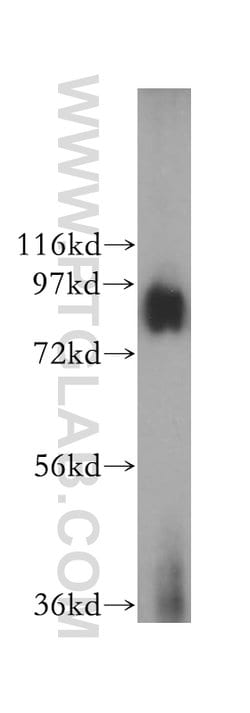 GGCX Rabbit anti-Human, Mouse, Rat, Polyclonal, Proteintech 150 &mu;L;