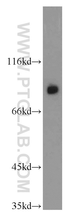 GGCX Rabbit anti-Human, Mouse, Rat, Polyclonal, Proteintech 150 &mu;L;