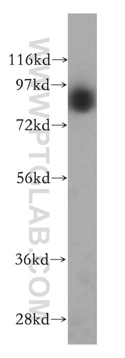 GGCX Rabbit anti-Human, Mouse, Rat, Polyclonal, Proteintech 150 &mu;L;
