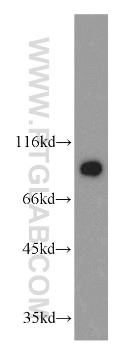 GGCX Rabbit anti-Human, Mouse, Rat, Polyclonal, Proteintech 150 &mu;L;