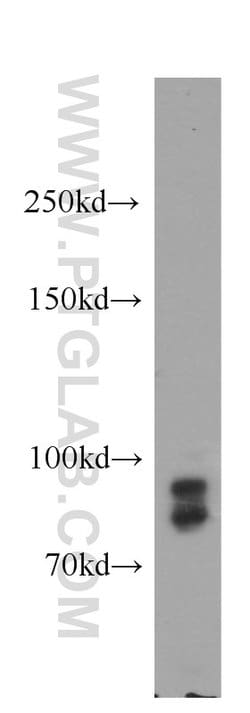 GGCX Rabbit anti-Human, Mouse, Rat, Polyclonal, Proteintech 150 &mu;L;