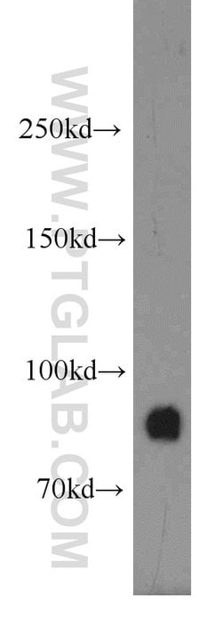 GGCX Rabbit anti-Human, Mouse, Rat, Polyclonal, Proteintech 150 &mu;L;