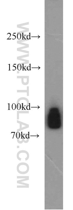 GGCX Rabbit anti-Human, Mouse, Rat, Polyclonal, Proteintech 150 &mu;L;