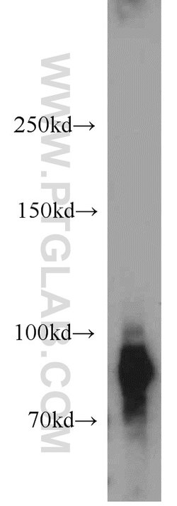 GGCX Rabbit anti-Human, Mouse, Rat, Polyclonal, Proteintech 150 &mu;L;
