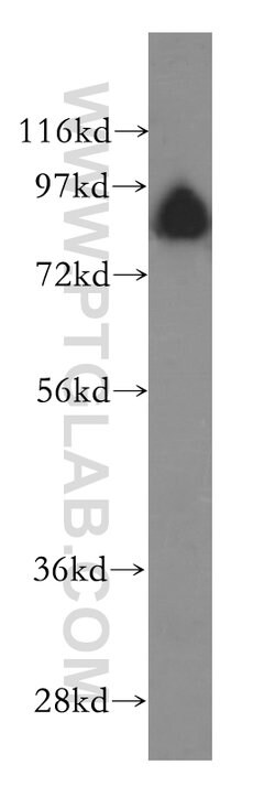GGCX Rabbit anti-Human, Mouse, Rat, Polyclonal, Proteintech 150 &mu;L;