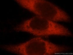 LDHAL6A Rabbit anti-Human, Mouse, Rat, Polyclonal, Proteintech 150 &mu;L;