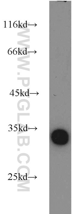 LDHAL6A Rabbit anti-Human, Mouse, Rat, Polyclonal, Proteintech 150 &mu;L;