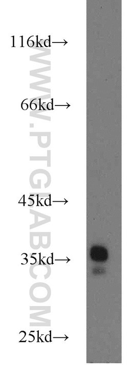 LDHAL6A Rabbit anti-Human, Mouse, Rat, Polyclonal, Proteintech 150 &mu;L;