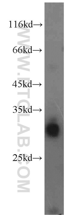 LDHAL6A Rabbit anti-Human, Mouse, Rat, Polyclonal, Proteintech 150 &mu;L;