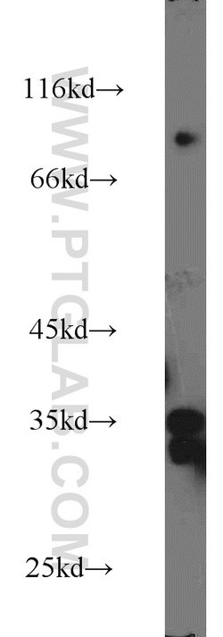 LDHAL6A Rabbit anti-Human, Mouse, Rat, Polyclonal, Proteintech 150 &mu;L;