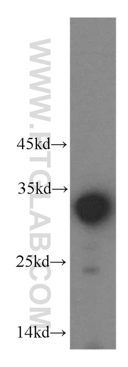 LDHAL6A Rabbit anti-Human, Mouse, Rat, Polyclonal, Proteintech 150 &mu;L;