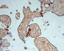 PDE4A Rabbit anti-Human, Mouse, Rat, Polyclonal, Proteintech 150 &mu;L;