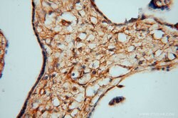 PDE4A Rabbit anti-Human, Mouse, Rat, Polyclonal, Proteintech 150 &mu;L;