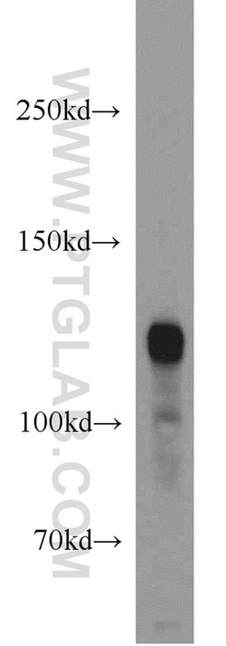 PDE4A Rabbit anti-Human, Mouse, Rat, Polyclonal, Proteintech 150 &mu;L;