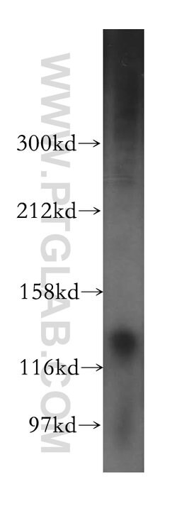 PDE4A Rabbit anti-Human, Mouse, Rat, Polyclonal, Proteintech 150 &mu;L;