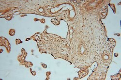 KDSR Rabbit anti-Human, Mouse, Rat, Polyclonal, Proteintech