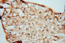 KDSR Rabbit anti-Human, Mouse, Rat, Polyclonal, Proteintech 150 &mu;L;