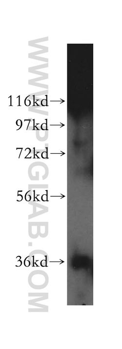 KDSR Rabbit anti-Human, Mouse, Rat, Polyclonal, Proteintech 150 &mu;L;