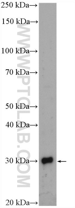 TINP1 Rabbit anti-Human, Mouse, Rat, Polyclonal, Proteintech:Antibodies:Primary