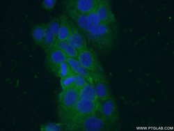 VIP Rabbit anti-Human, Mouse, Polyclonal, Proteintech 150 &mu;L; Unconjugated:Antibodies,