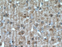 VIP Rabbit anti-Human, Mouse, Polyclonal, Proteintech 150 &mu;L; Unconjugated:Antibodies,