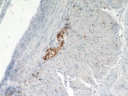 VIP Rabbit anti-Human, Mouse, Polyclonal, Proteintech 150 &mu;L; Unconjugated:Antibodies,