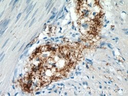 VIP Rabbit anti-Human, Mouse, Polyclonal, Proteintech 150 &mu;L; Unconjugated:Antibodies,